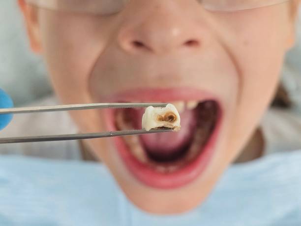 Best Emergency Dental Services for Seniors in West Des Moines, IA